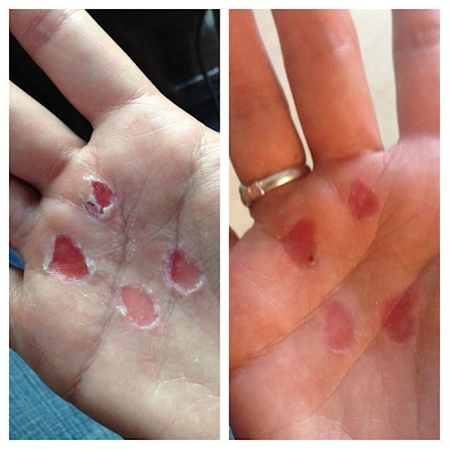 Baume réparateur RipFix